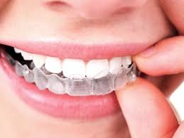Breaking Common Myths About Invisalign