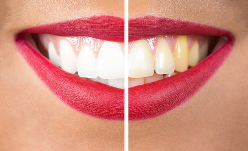 How a Cosmetic Dentist Can Help Improve Your Smile