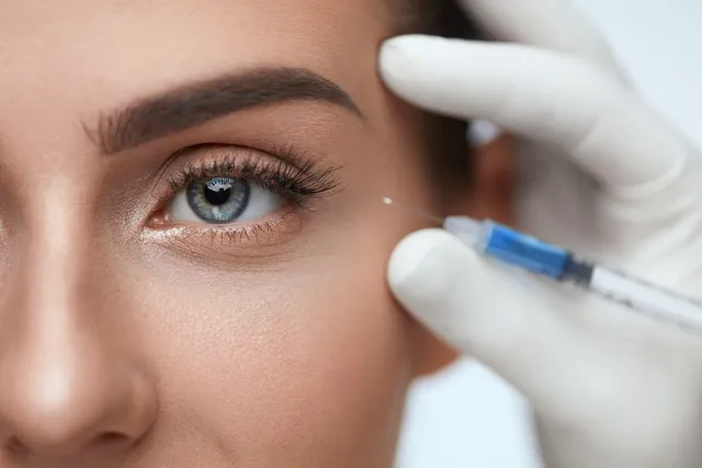 The Popularity of Preventative Botox Among Younger Clients