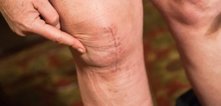 A Comprehensive Guide to Understanding Joint Pain