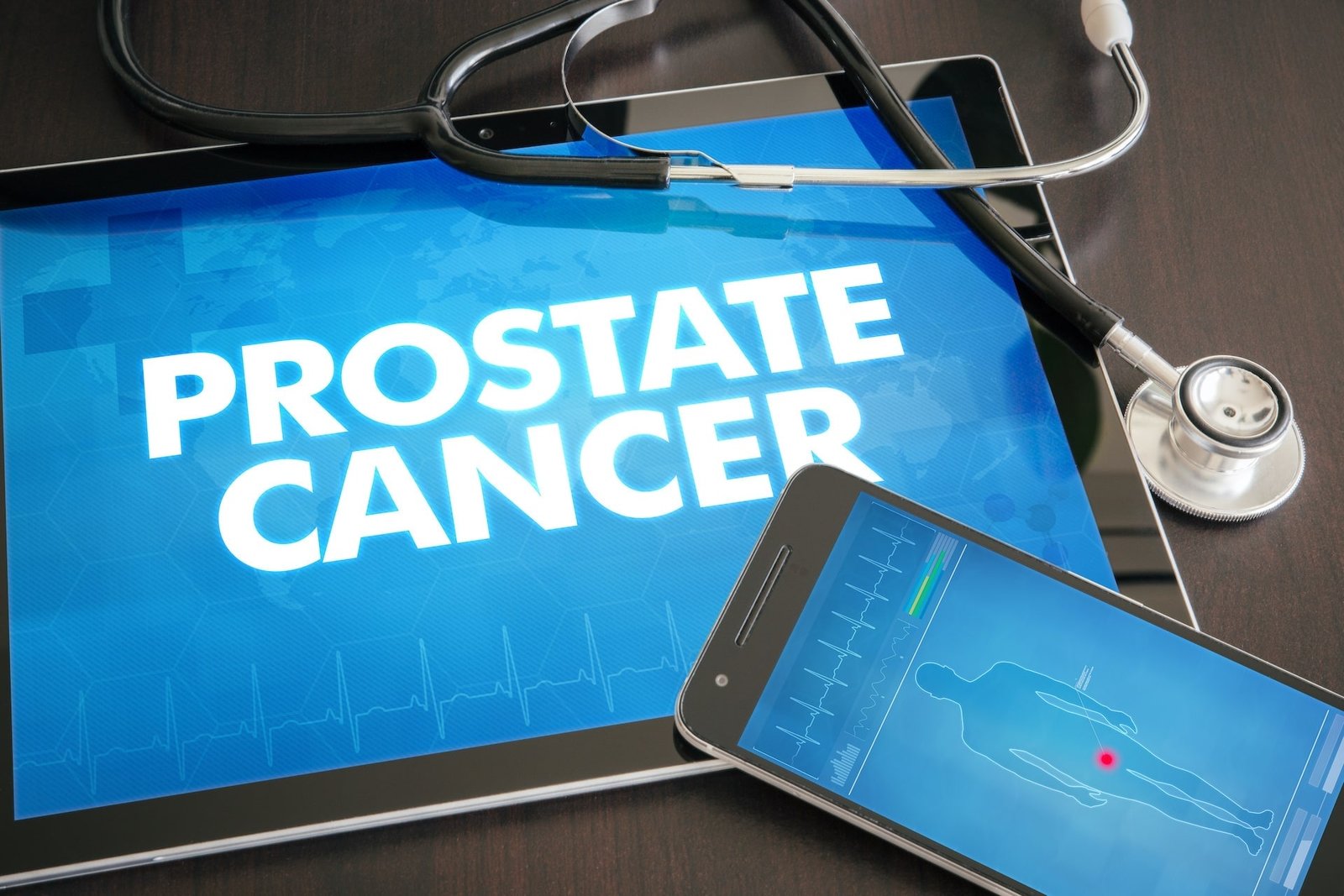Advances in Prostate Cancer Treatment Options