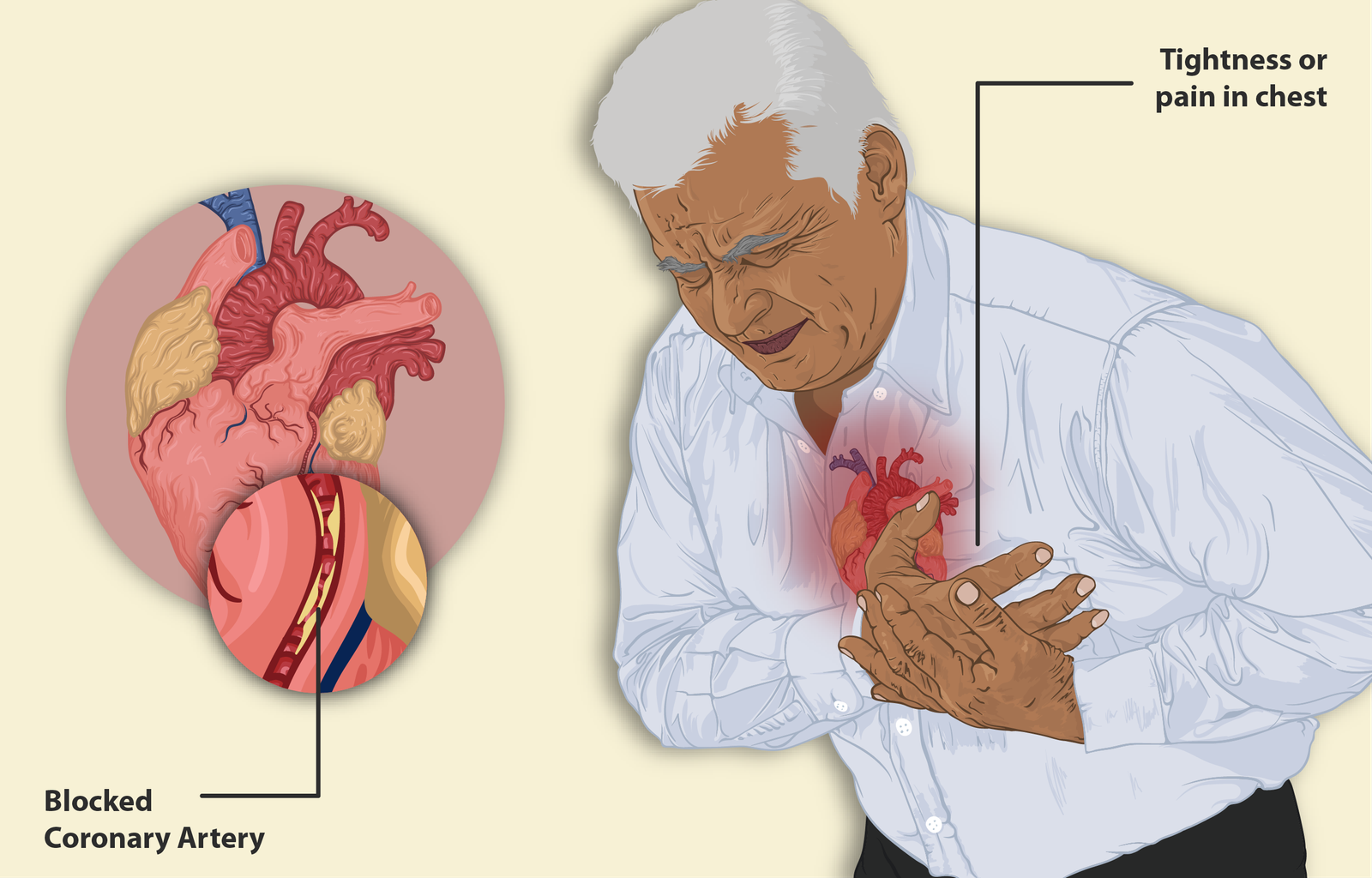 Differentiating Between Chest Pain and Heart Attack Symptoms