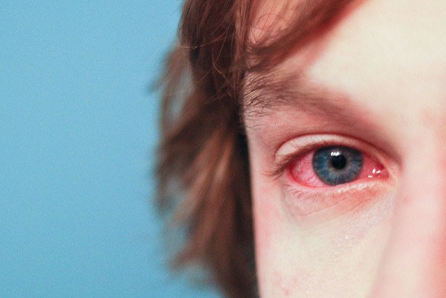 How Allergists Diagnose and Treat Allergic Reactions