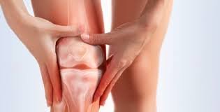 How to Alleviate Pain and Stiffness Associated With Knee Arthritis