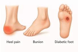 Identifying When To See a Podiatrist for Foot Pain