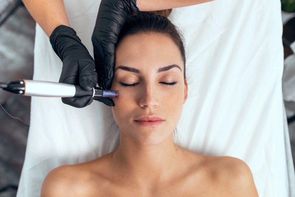 Microneedling Aftercare Tips and Guidelines