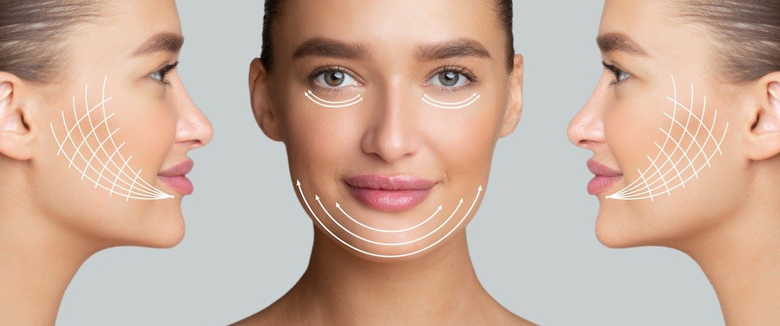 Techniques in Face Lift Surgery