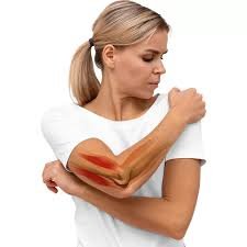 Tips for Preparing for Elbow Surgery