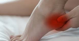 Understanding Plantar Fasciitis and Its Impact on Heel Pain