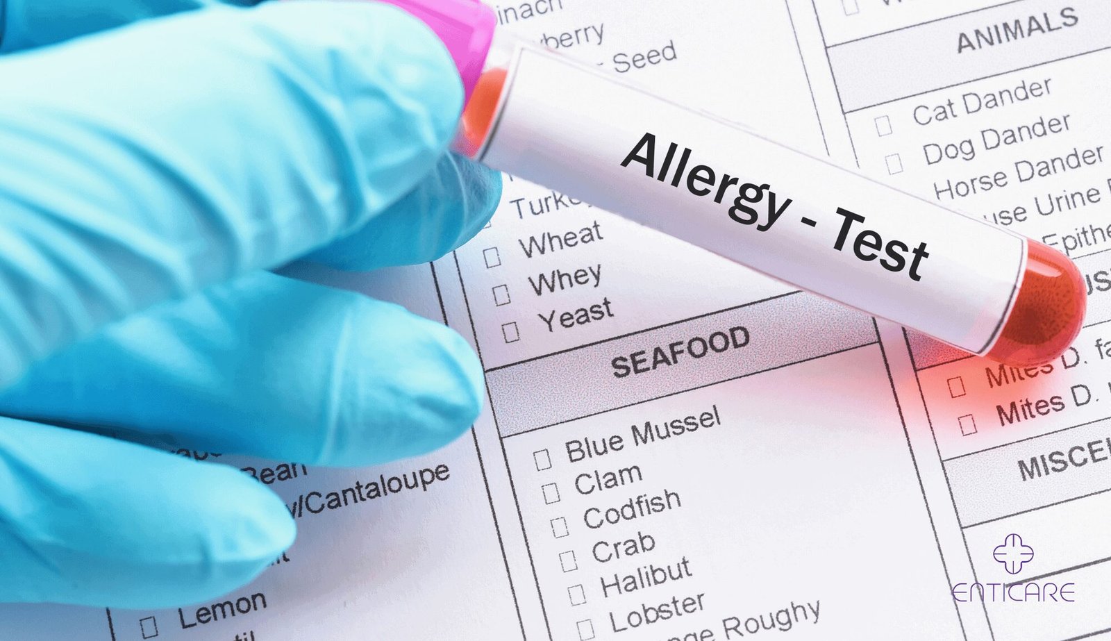 Understanding the Different Types of Allergy Testing Available
