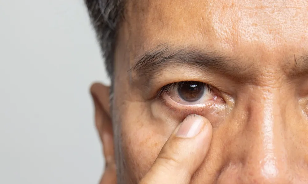 Understanding the Long-term Effects of Untreated Cataracts