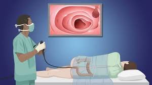 What To Expect During a Colonoscopy Procedure