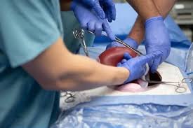 What To Include in Your Post-Surgery Care Plan for Gallbladder Removal