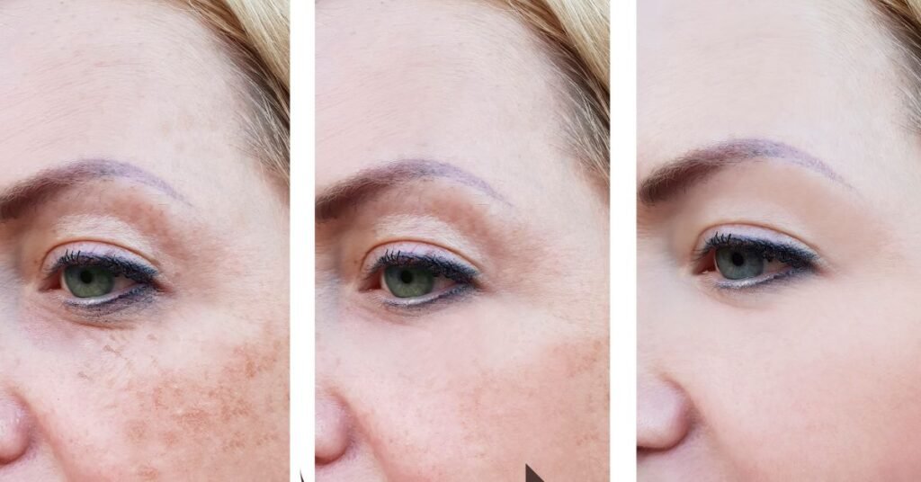What to Expect Before and After Your First Botox Treatment