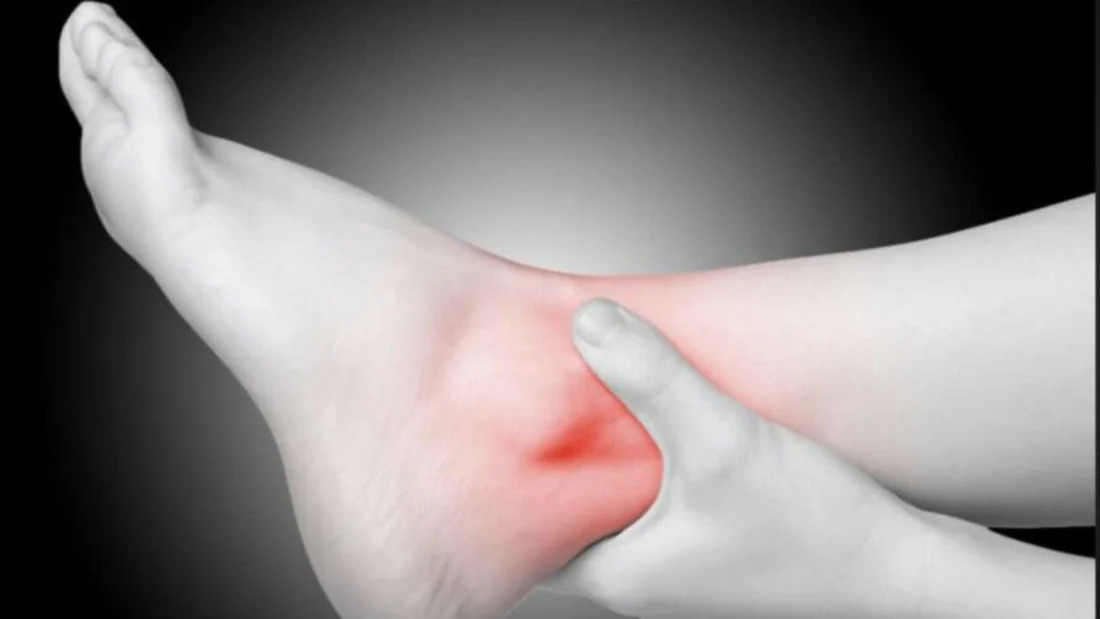 Tips for a Faster Ankle Injury Recovery