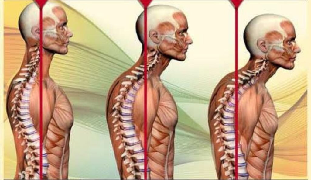 Understanding the Relationship Between Neck Pain and Posture